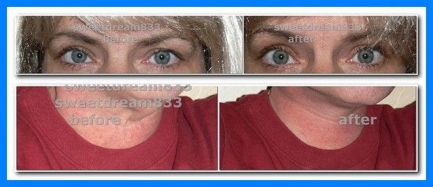 INSTANT FACE LIFT ADHESIVE TAPE EYES NECK BROWS LIFTING FACELIFT